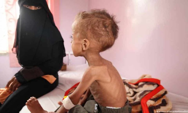 مجاعة اليمن