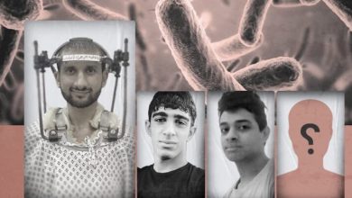 العفو الدولية تحذر من تفشي مرض السل في سجن جو البحريني