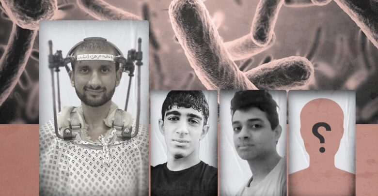 العفو الدولية تحذر من تفشي مرض السل في سجن جو البحريني